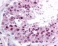 DNMT / DNMT1 Antibody (aa1603-1616)